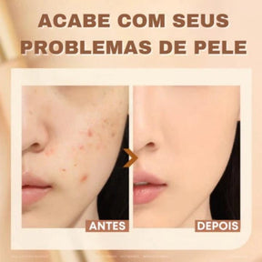 Corretivo Focallure 2 em 1 - Anti Manchas e Rejuvenescedora