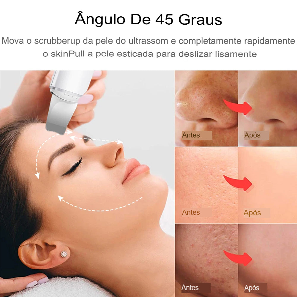 DermaPure Pro Ultrassônico Portátil