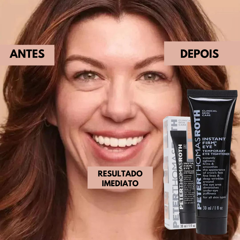 Creme Antirrugas Instantâneo - Recupere a tua Confiança