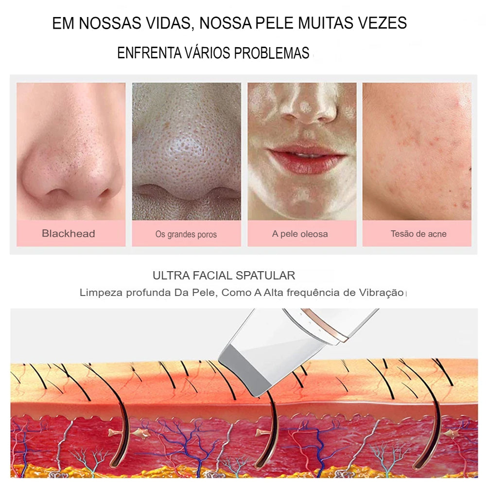 DermaPure Pro Ultrassônico Portátil